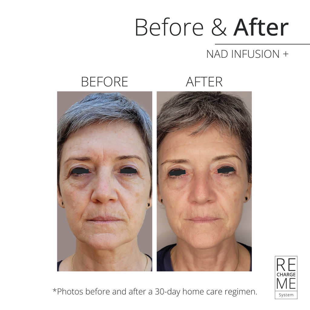 RECHARGE ME RECHARGE ME NAD INFUSION Perfume