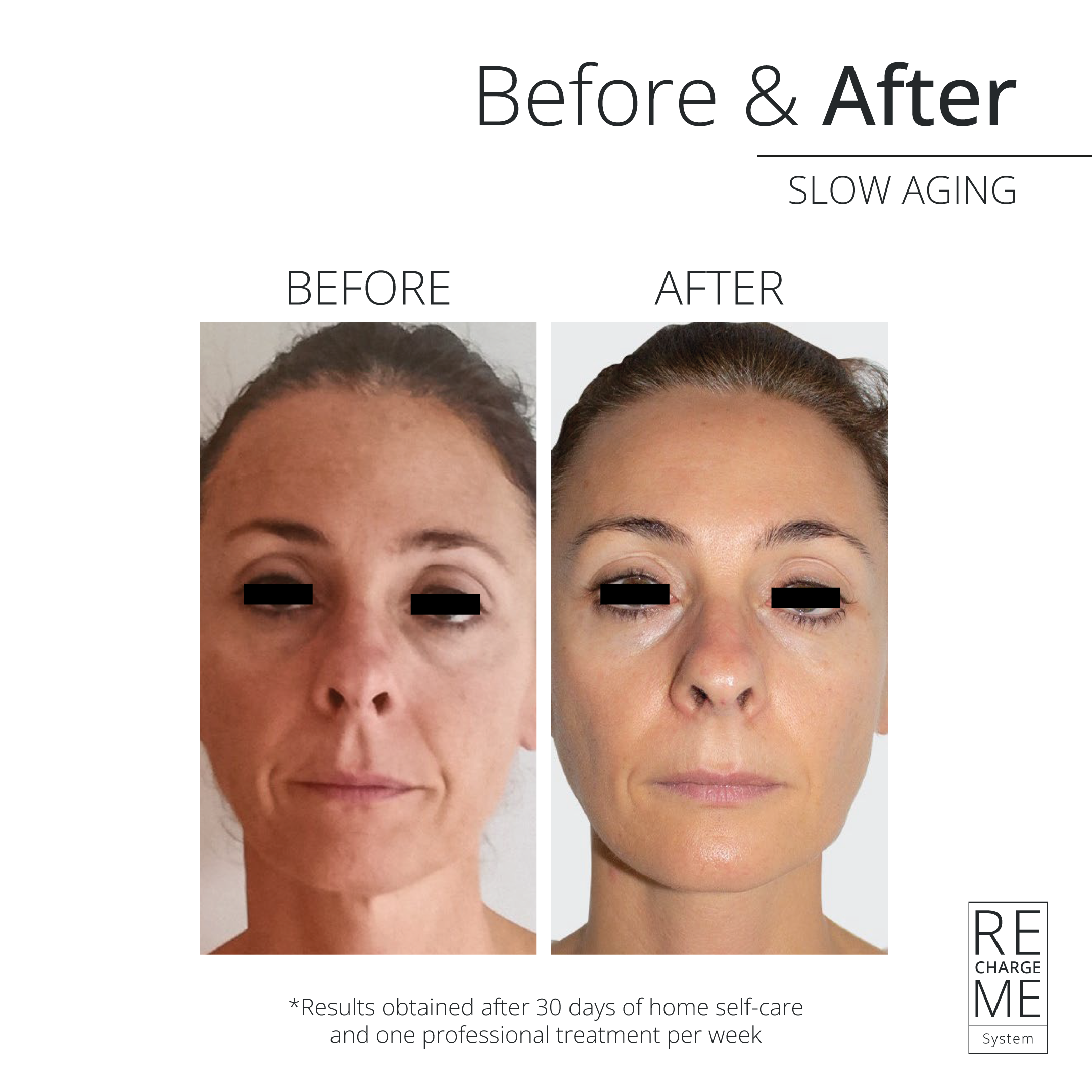Emotion Beauty Supply RECHARGE ME SLOW AGE SUERO FACIAL SPRAY