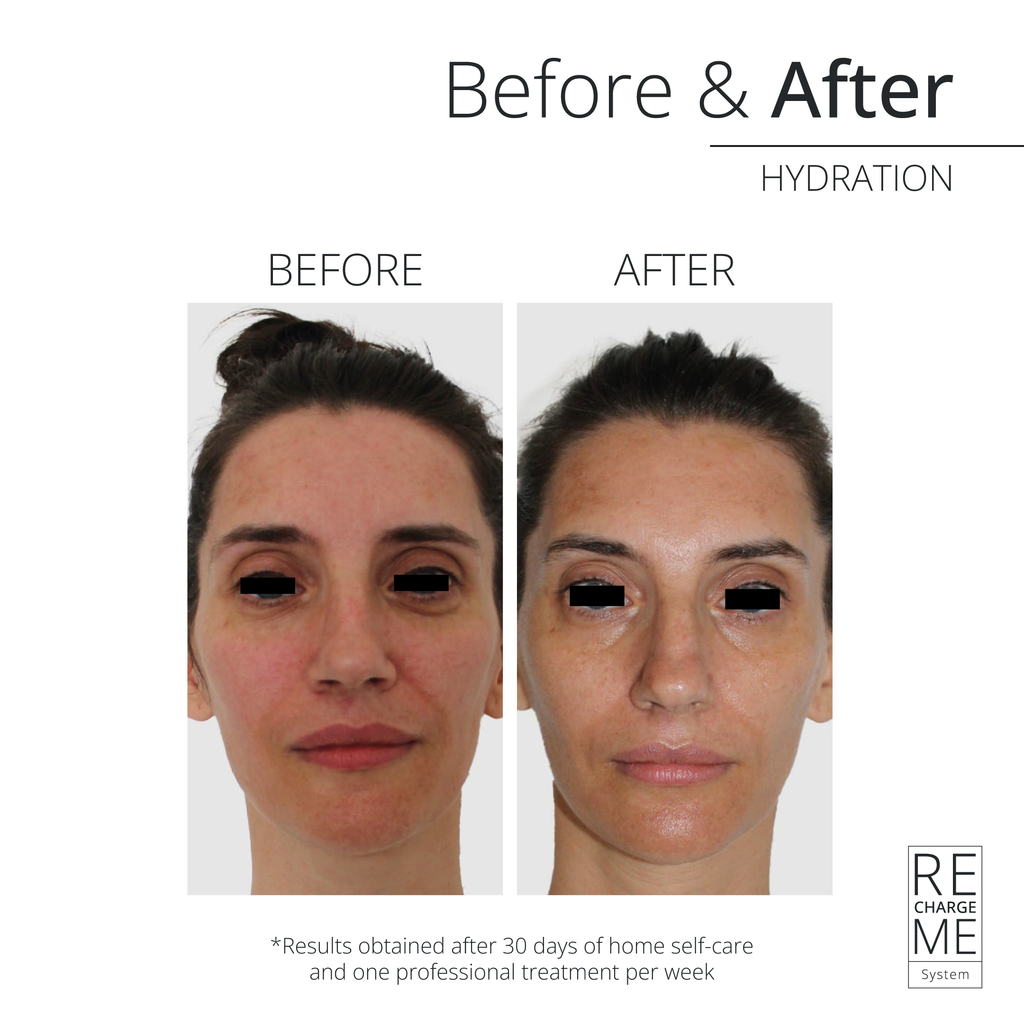 RECHARGE ME RECHARGE ME HYDRA SUERO FACIAL SPRAY – Sérum Facial Hidratante en Spray